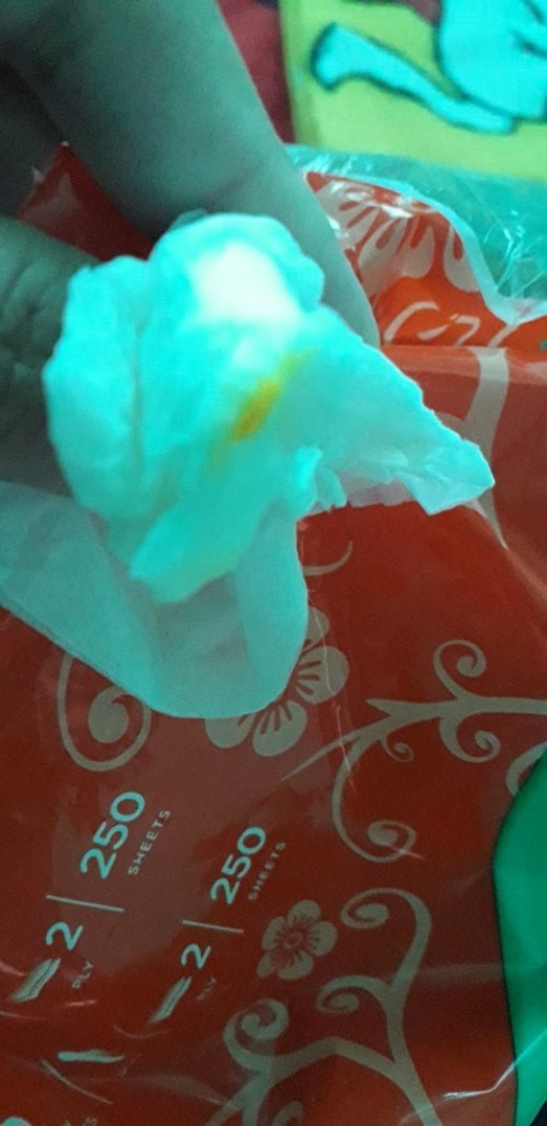 cairan kuning