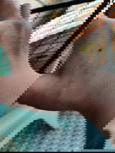 breast milk while having itcheness