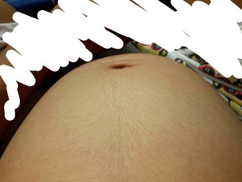 22w3d 👶😍