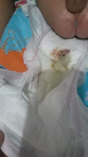 please help po,excuse po sa kumakain