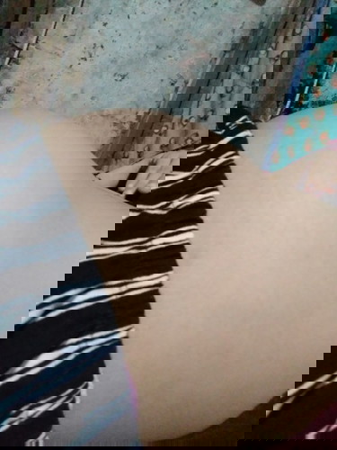 normal lang poba ang paninigas ng tiyan??