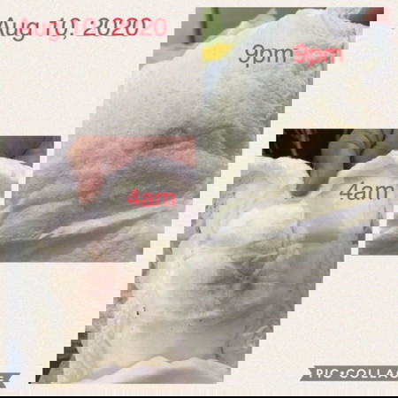 Blood on diaper/urine