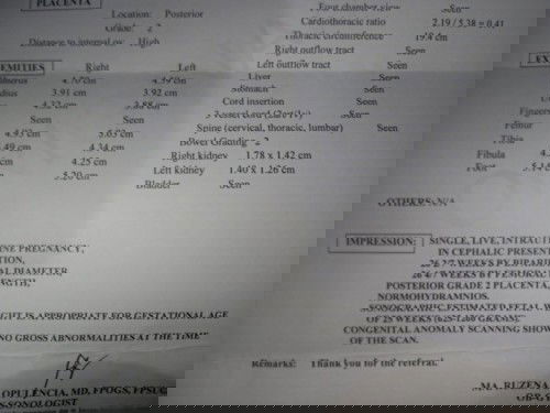 Okay naman po ba ultrasound ko?