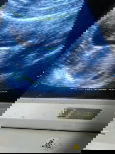 Usia kandungan jalan 4bulan tapi belum kerasa apa" wajar ngga ya bun, bth masukan soalnya sy prnh BO