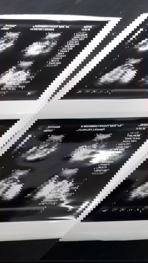 Penggunaan BPJS dgn KK yg masih sendiri