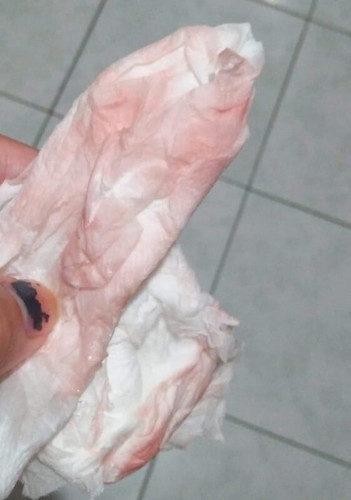Light pink discharge 6 weeks pregnant
