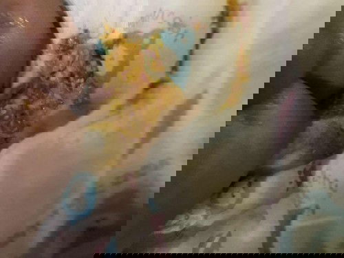 น้องถ่ายปนเลือดเส้นฝอยๆออกมาเกิดจากอะไร❓