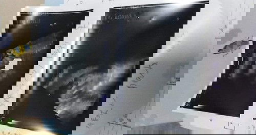 สรุปเราได้ผู้หญิ่งคะ