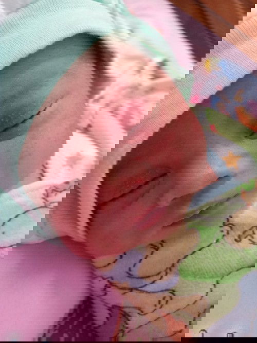 Bintik seperti milia