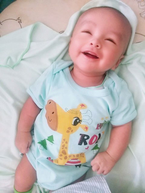 Bayi sering liat ke atas