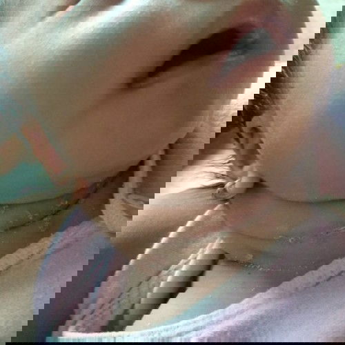 Beruntusan bagian leher