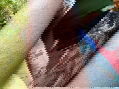 gatal seperti biduran saat hamil 36 Week