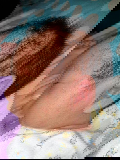 Biang kringet atau sarap