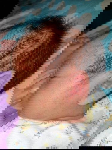 Biang kringet atau sarap