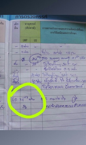 ยังไม่ทราบเลยค่ะว่าน้องหญิงชาย คุณแม่ช่วยดูหน่อยใด้มั้ยค่ะว่าที่ วงใว้ใช้เพศน้องหรือเปล่า