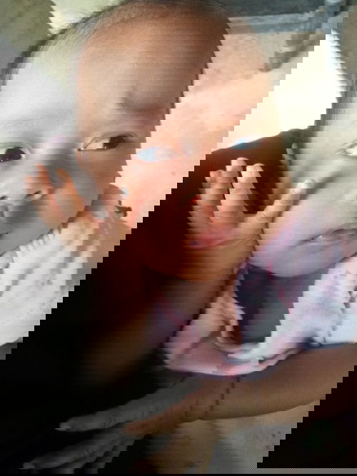 น้องคลอดก่อนกำหนด ตอน 34 week