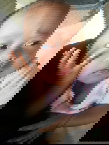 น้องคลอดก่อนกำหนด ตอน 34 week