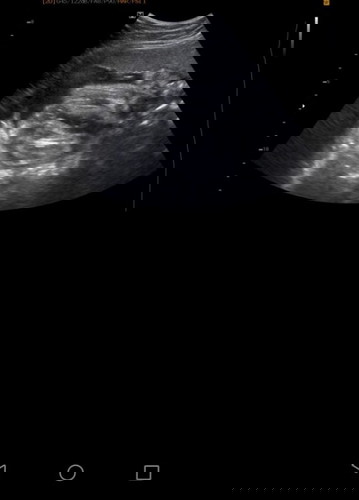 Is This Boy Or Girl?