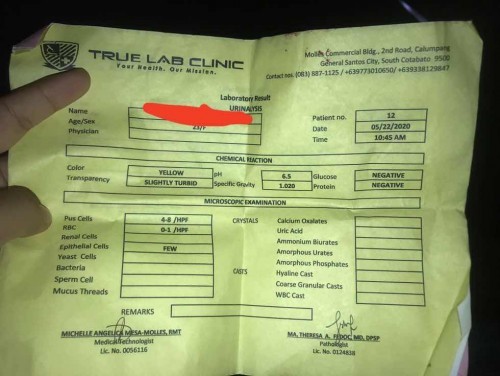 Urinalysis result