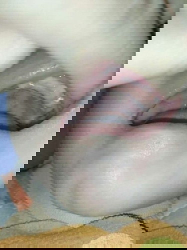 ใช่ฟันนมไมคะ