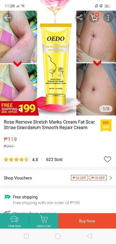 Stretchmark remover