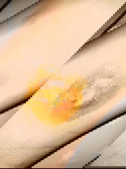 ตั้งครรภ์ กำหนดคลอดอาทิดหน้า