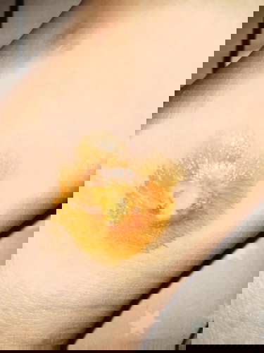 ตั้งครรภ์ กำหนดคลอดอาทิดหน้า