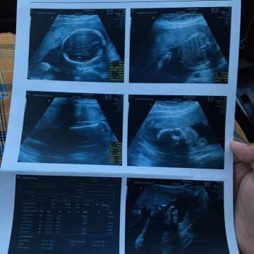 เเม่เดือน พ.ย. ไปถึงไหนกันบ้างแล้วคะน้ำหนักน้อง