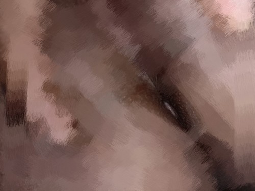 Almoranas or Hemorrhoids