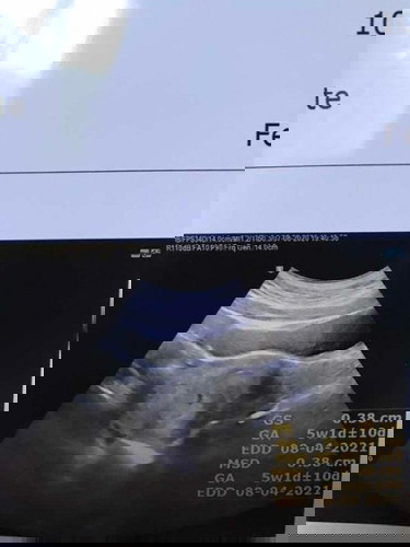 ใครซาวด์ท้อง4weeksบ้างคะ