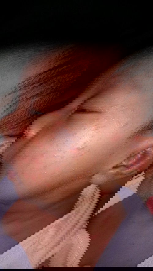 ano kaya ang lunas dito?