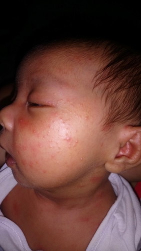 ano kaya ang lunas dito?