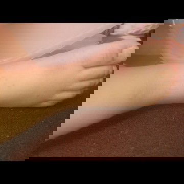 Ruam / bentol merah di kaki