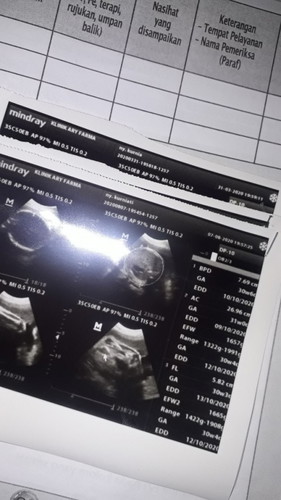 usia kehamilan memasuki 32week usg kmarin berat badan janin 1.666gram apakaah wajar bund ? soalnya usg di dokter umum. belum ke bidan dan spog... karena terkendala korona dan jadwal dokter belum pas . mohon pencerahan bund. dokter umum nya penjelasannya k