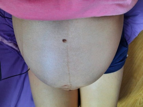 กระตุ้นคลอด