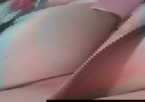 #ท้องลาย