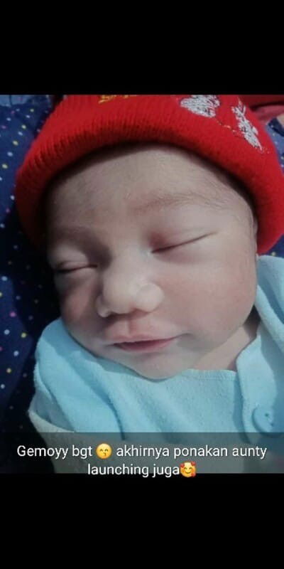 Alis bayi tiba tiba hilang