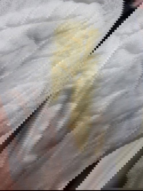 39+2 มีร้ำเหลืองไหลออกมา ไม่มั้นใจว่าคือตกขาวหรือ อะไร ควรไปหาหมอไหมค่ะ