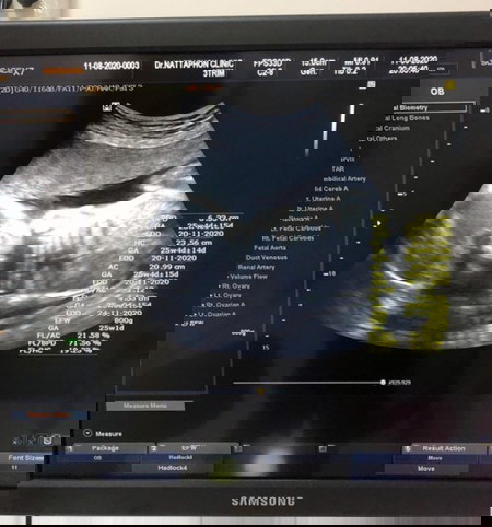 น้ำหนักลูก