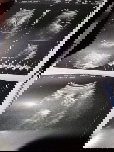 Question lang po mga mums