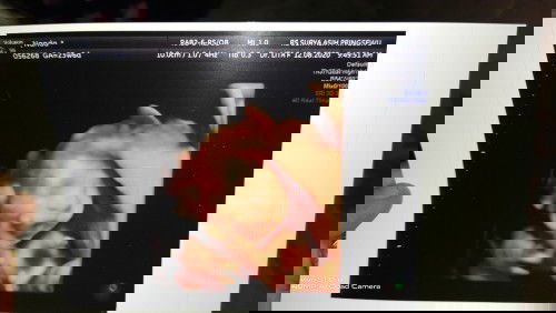 tiap usg beda hpl nya