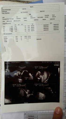 อัตราซาวลูก 👶 28w 6d