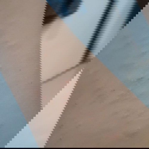 bintik2 kecil berair