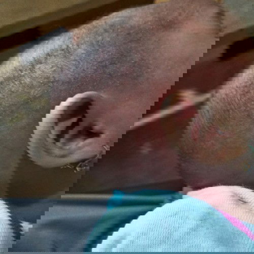 Keringetan di kepala dan tangan