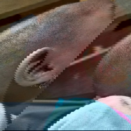 Keringetan di kepala dan tangan