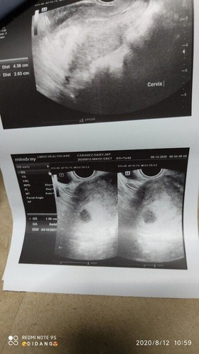 5weeks and 4days