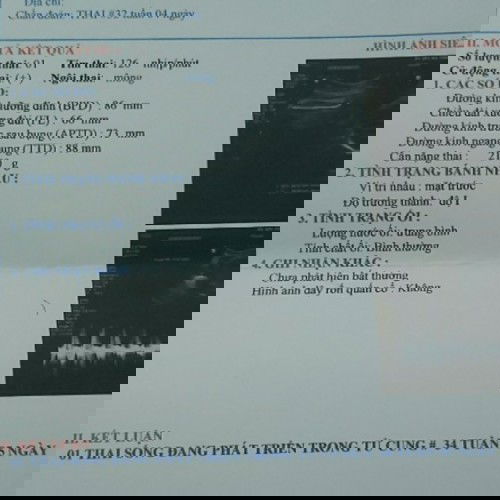 Tuần thai nào chính xác