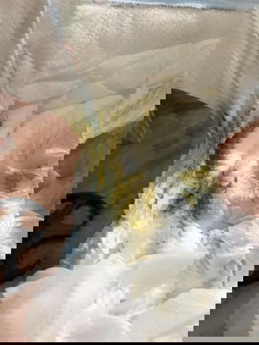 Nag tatae ba si baby?