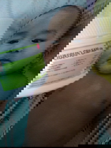 Kesan guna aqueous cream