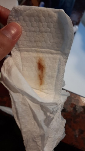 is this Mucus Plug???
